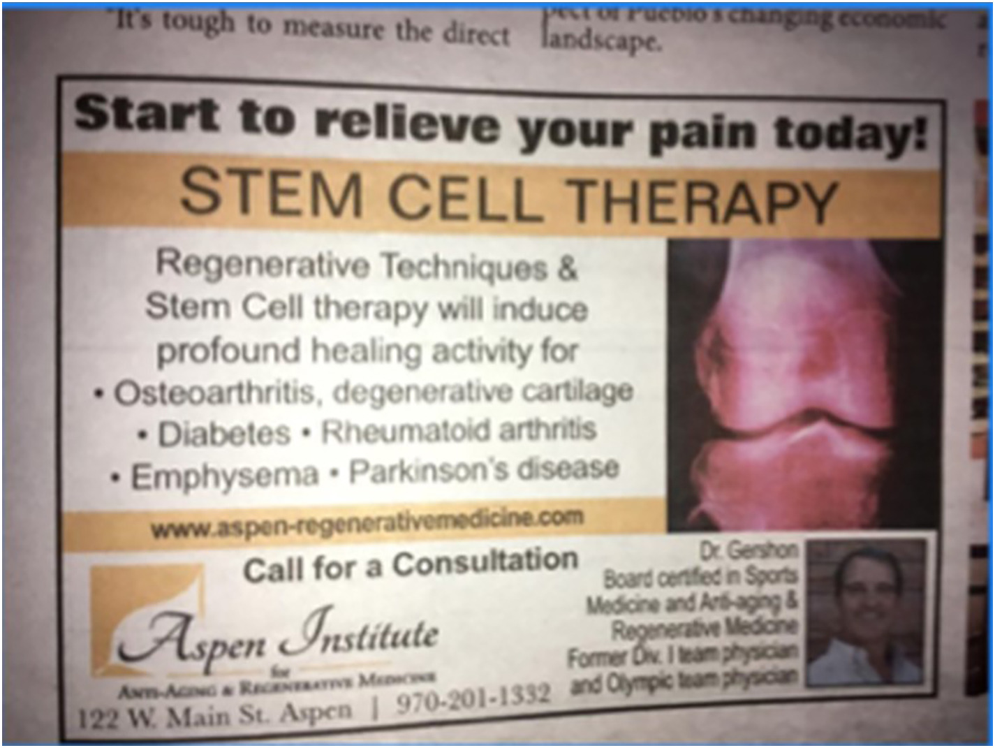 間充質(zhì)干細胞治療1型糖尿病臨床應用案例 間充質(zhì)干細胞治療1型糖尿病臨床應用案例