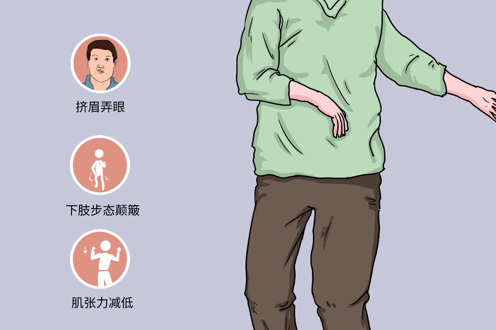 干細胞療法治療亨廷頓病的臨床前試驗進(jìn)展