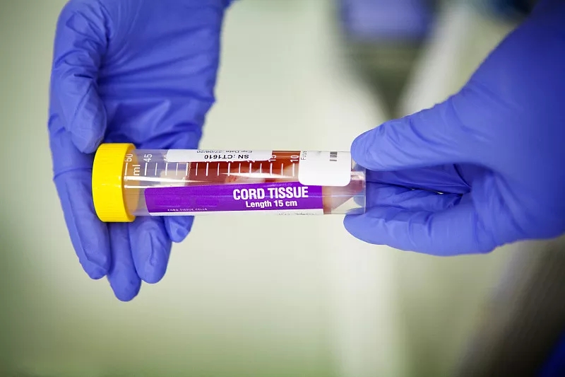 間充質(zhì)干細胞的優(yōu)點(diǎn)有哪些？