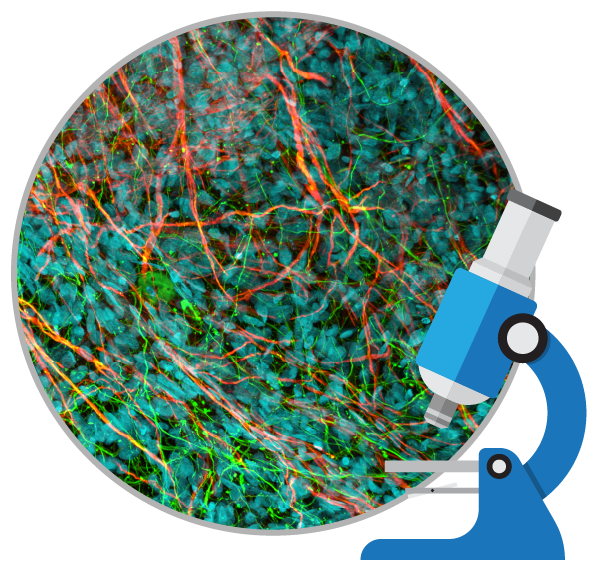 干細胞治療如何對自閉癥患者提供幫助？