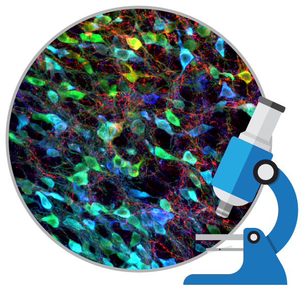 盤(pán)點(diǎn)：干細胞移植治療帕金森病的臨床研究進(jìn)展