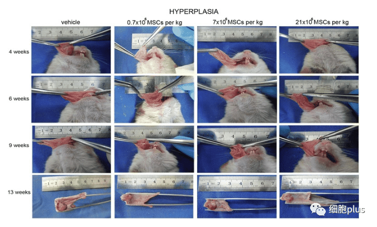 全身注射同種異體間充質(zhì)干細胞不會(huì )加速癌前病變的進(jìn)展