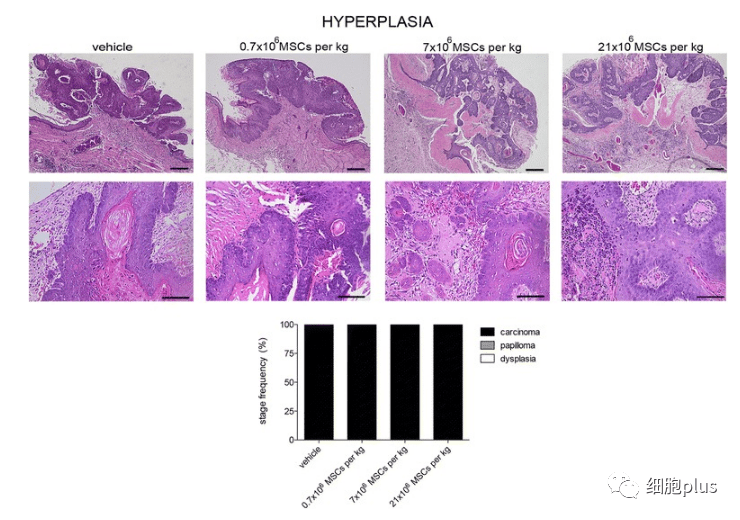 2?全身施用同種異體間充質(zhì)干細胞不會(huì )增加腫瘤惡性程度