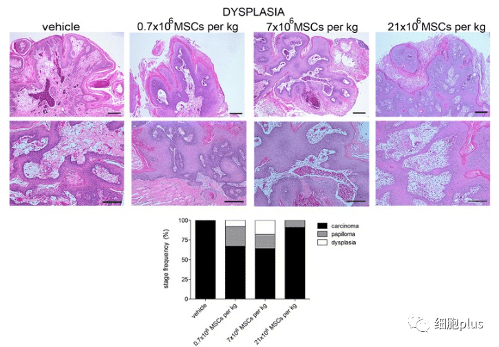 在增生期，全身注射同種異體間充質(zhì)干細胞不會(huì )增加腫瘤的惡性程度。