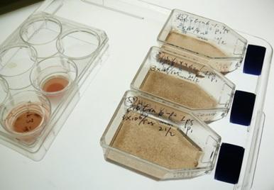 用生長(cháng)因子培養的胚胎和誘導多能 (iPS) 干細胞變得有色素(棕色)并顯示出視網(wǎng)膜色素上皮細胞的特征