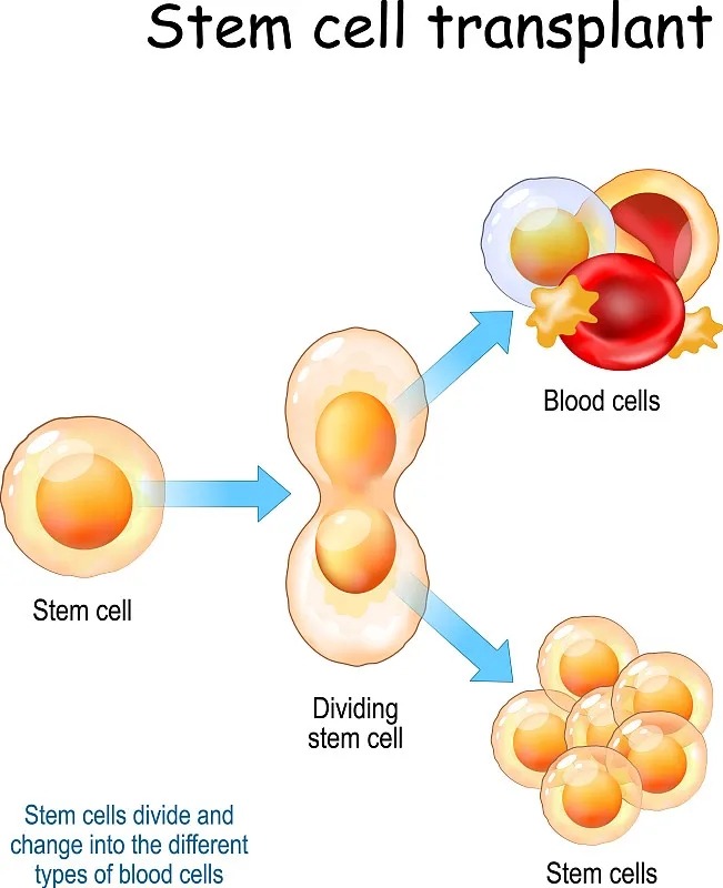 干細胞移植的流程分為那五個(gè)階段