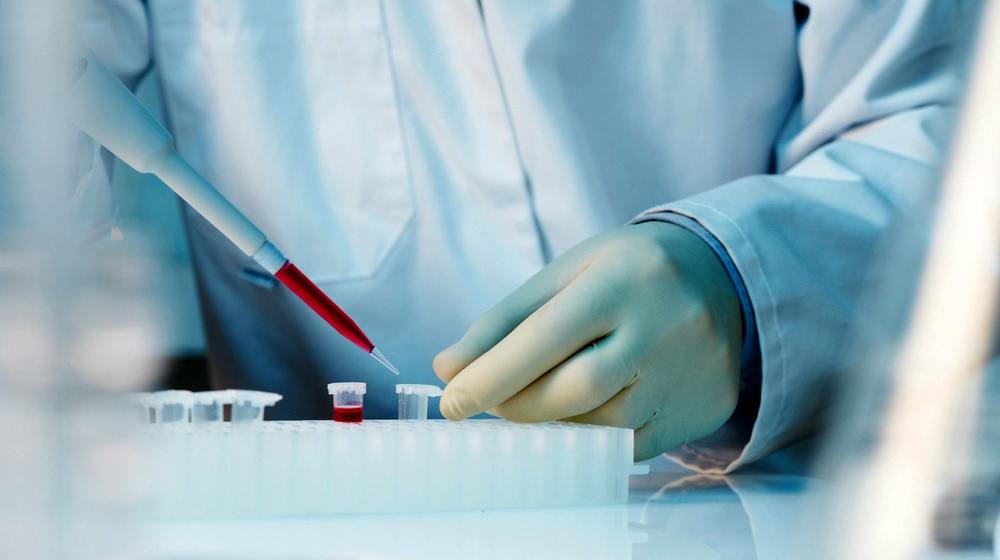 什么是干細胞移植-干細胞移植的流程和優(yōu)勢 什么是干細胞移植-干細胞移植的流程和優(yōu)勢