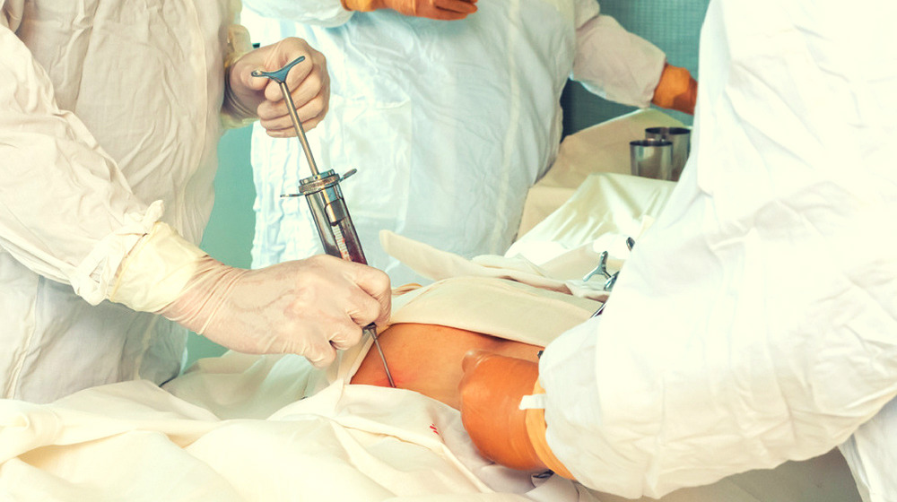 關(guān)于自體干細胞移植的須知