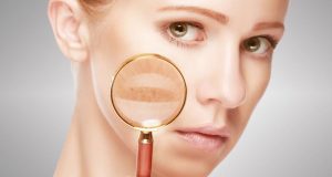 間充質(zhì)干細胞治療系統性紅斑狼瘡