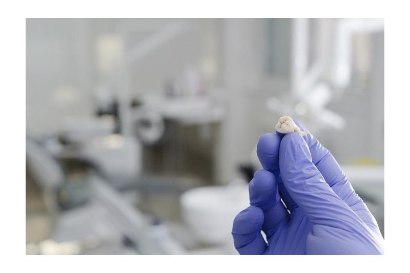 來(lái)自牙齒的干細胞可以幫助治療抑郁癥