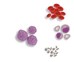 用于移植的干細胞可以來(lái)自骨髓或血液 用于移植的干細胞可以來(lái)自骨髓或血液