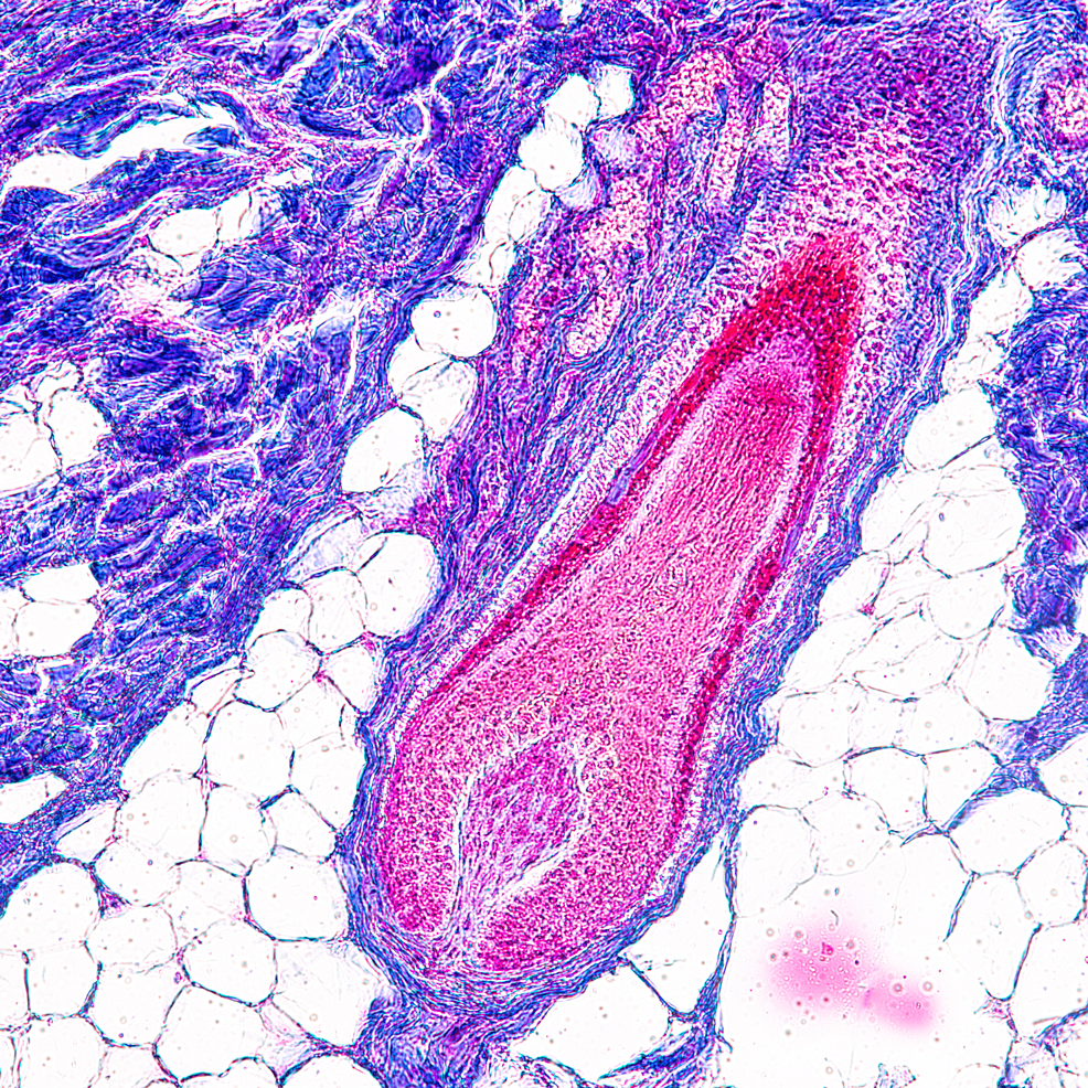 毛囊組織學(xué)觀(guān)察