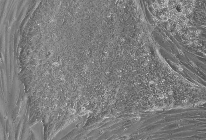 胚胎干細胞移植的來(lái)源