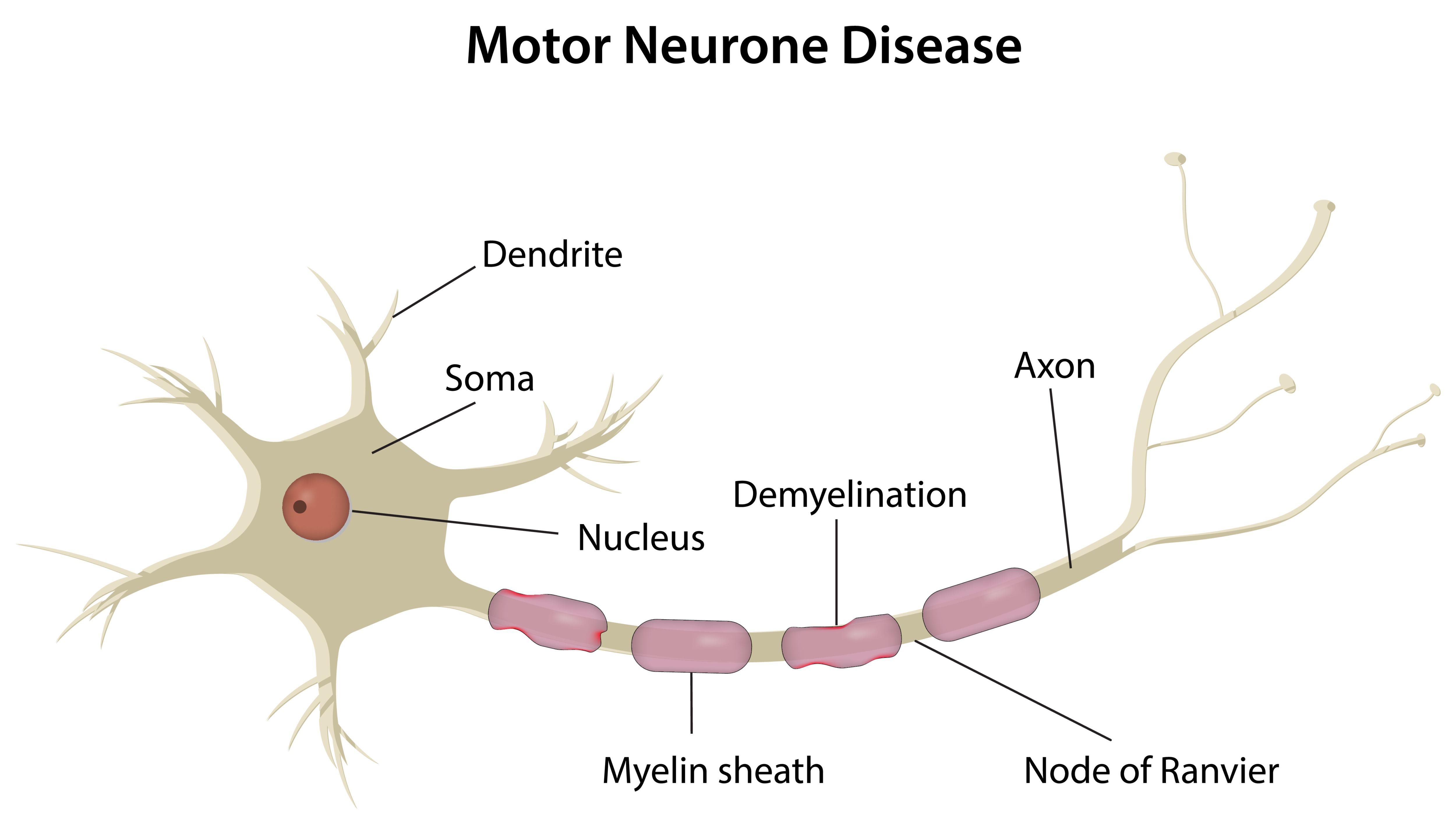 什么是運動(dòng)神經(jīng)元??？