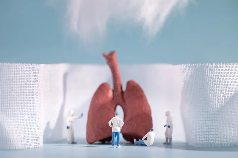 慢性阻塞性肺?。–OPD）的四個(gè)階段