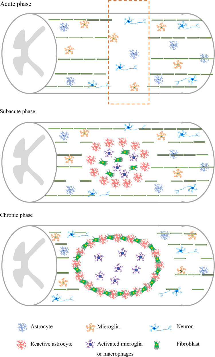 圖1：脊髓損傷不同階段的病理特點(diǎn)。