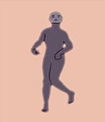 運動(dòng)障礙型腦癱涉及過(guò)度的不自主運動(dòng)。
運動(dòng)障礙性腦癱的類(lèi)型
肌張力障礙：僵硬和松弛交替出現，
舞蹈徐徐樣腦癱：持續的不自主運動(dòng)導致姿勢異常。