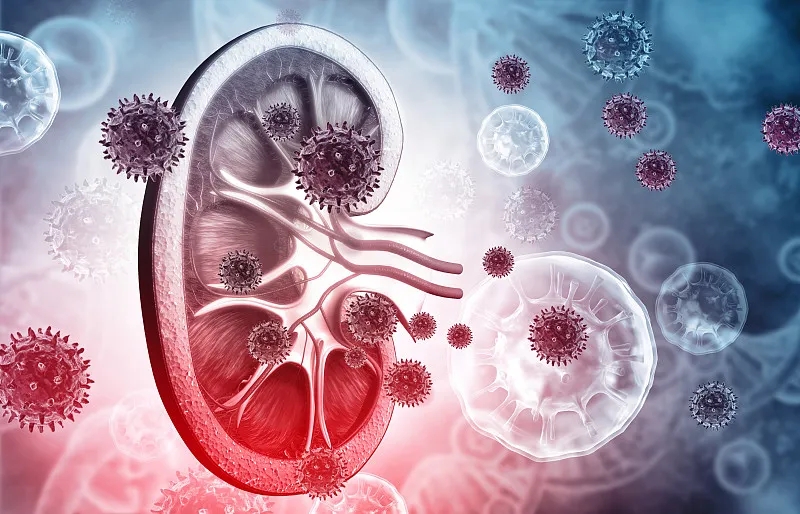 狼瘡性腎炎的體征和癥狀是什么？及其治療方法