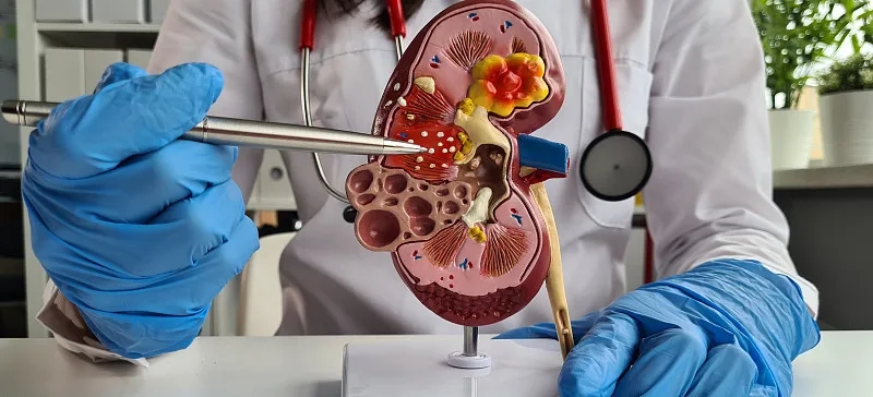 狼瘡的治療方法有哪些？