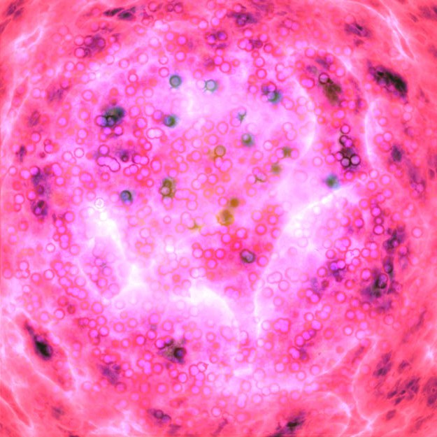 干細胞簡(jiǎn)介| 帕金森病的干細胞治療