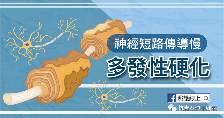 干細胞作為神經(jīng)退行性疾病的潛在治療方法之多發(fā)性硬化癥篇