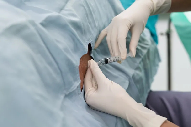 干細胞，-鞘內給藥，-神經(jīng)系統疾病