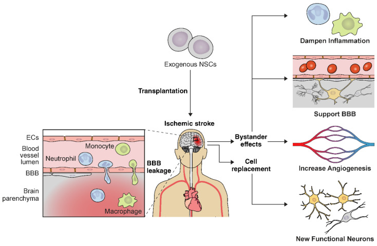 神經(jīng)干細胞移植治療缺血性腦卒中的作用機制