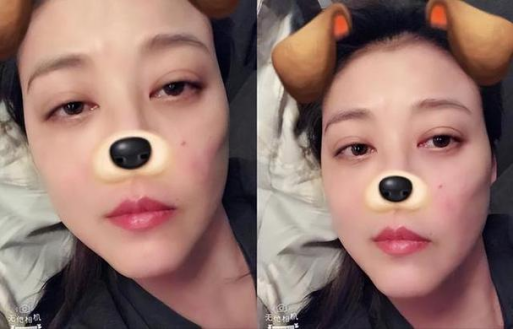 △ 周海媚之前發(fā)布的自拍照中也隱約可見(jiàn)面部紅斑