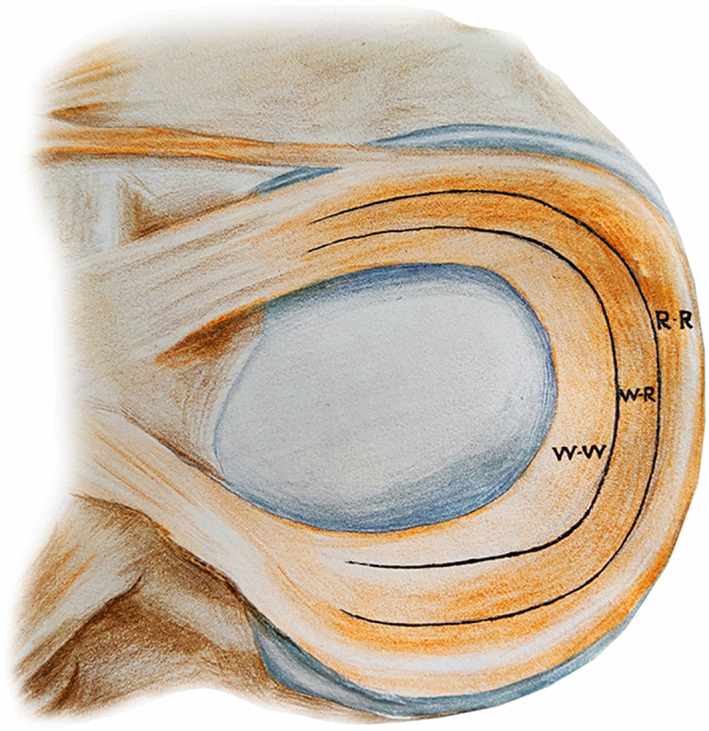 圖1：根據報告的血管分布，半月板的插圖展示了經(jīng)典的三個(gè)區域