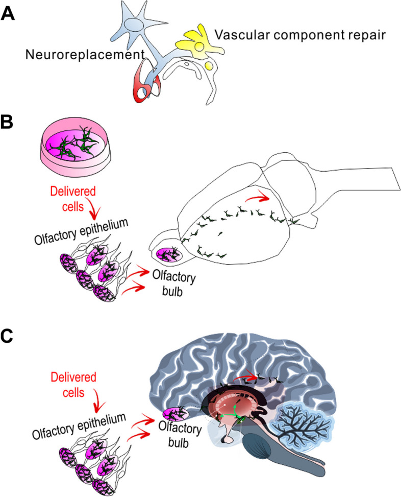 圖1：干細胞移植治療帕金森病的示意圖。