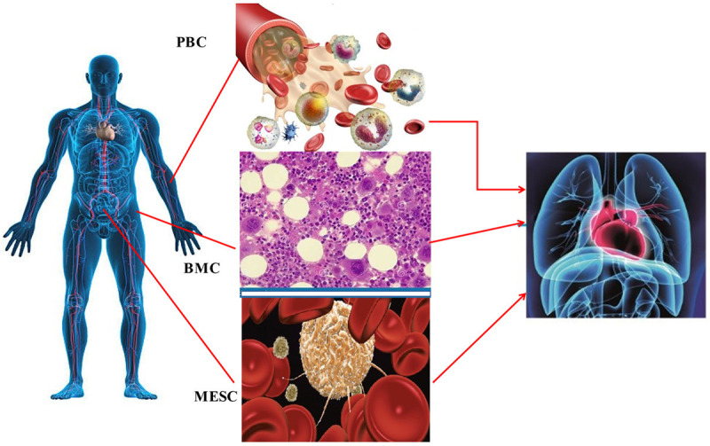 圖1：用于慢性缺血性心臟病移植的不同類(lèi)型的干細胞