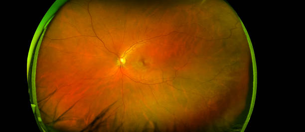 北大人民醫院眼科研究所：干細胞治療遺傳性視網(wǎng)膜疾病研究看點(diǎn)