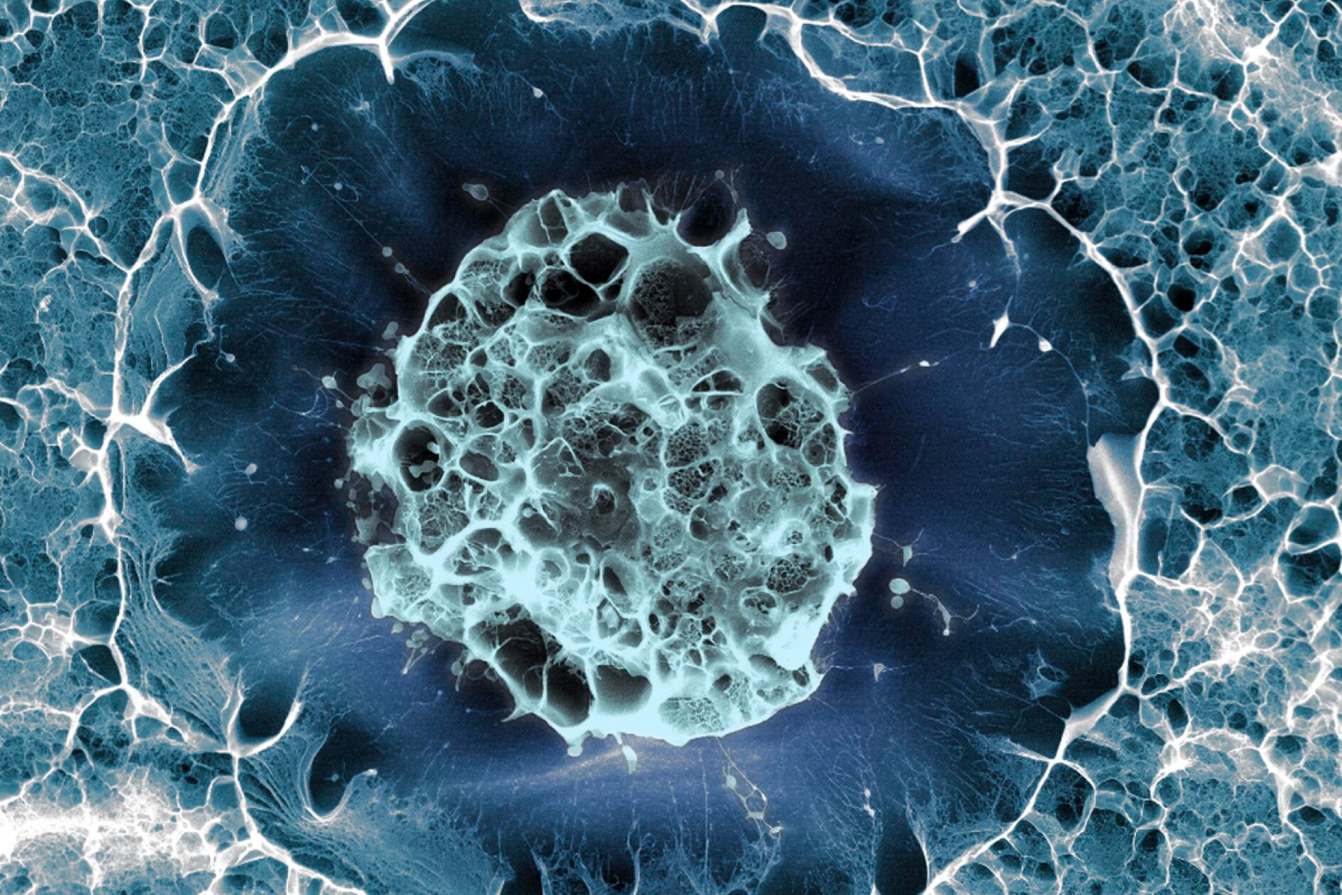 基于人類(lèi)干細胞的帕金森病療法被證明是安全的 基于人類(lèi)干細胞的帕金森病療法被證明是安全的