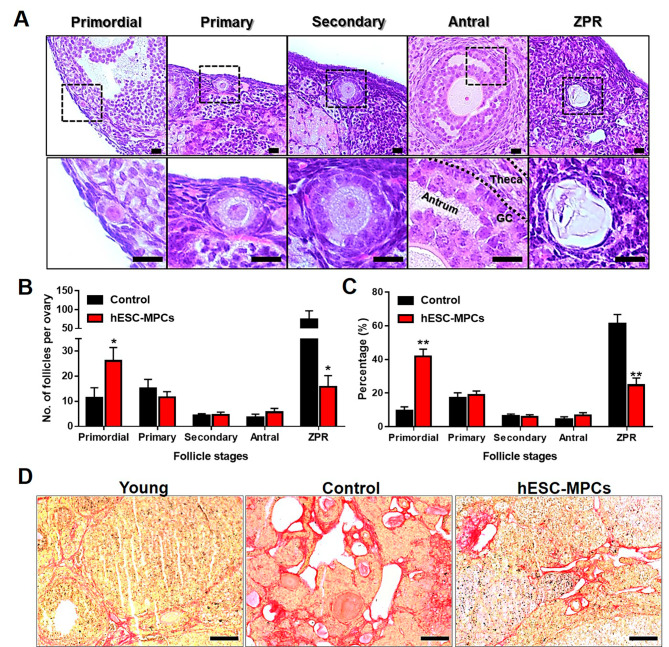 圖3：通過(guò)在圍絕經(jīng)期小鼠中多次引入人胚胎干細胞衍生的間充質(zhì)祖細胞（hESC-MPC）來(lái)維持卵巢儲備。