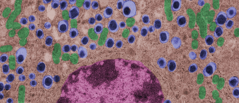 利用間充質(zhì)干細胞治療1型糖尿病的潛力如何？
