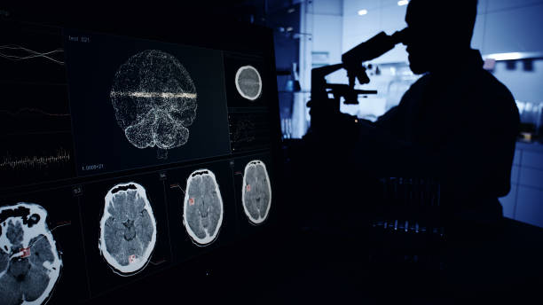 神經(jīng)系統疾病發(fā)病機制復雜，涉及基因突變、衰老過(guò)程等多種因素。