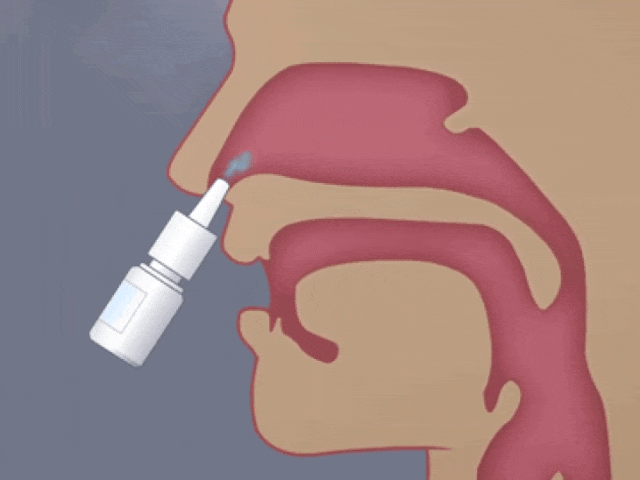 日本居家干細胞噴鼻能治療腦梗死：是科學(xué)突破還是商業(yè)噱頭？