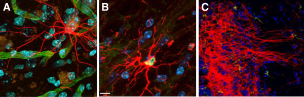 圖3：人類(lèi)中樞神經(jīng)系統干細胞 (HuCNS-SC) 根據其遷移位點(diǎn)優(yōu)先分化為特定譜系。