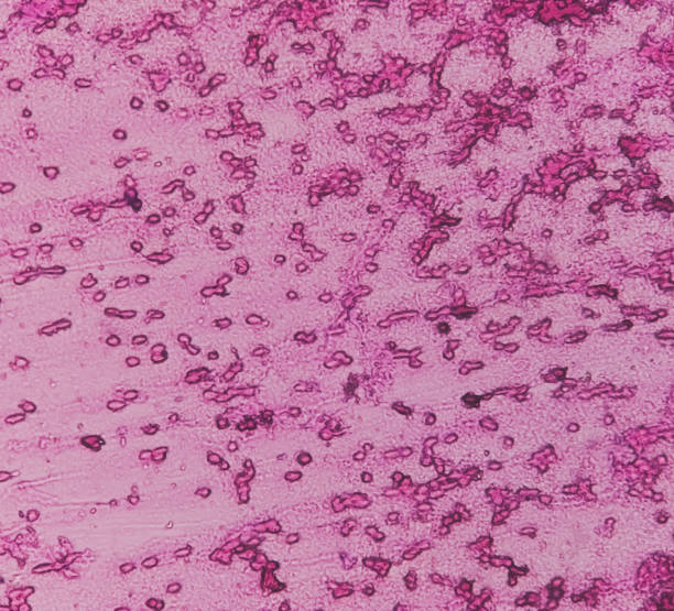 人羊膜上皮細胞對中樞神經(jīng)系統損傷和疾病的治療潛力