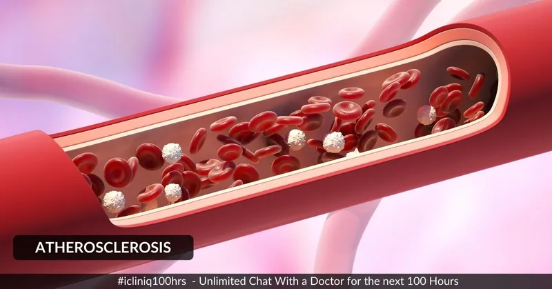 動(dòng)脈粥樣硬化的體征和癥狀是什么？治療方案有哪些？