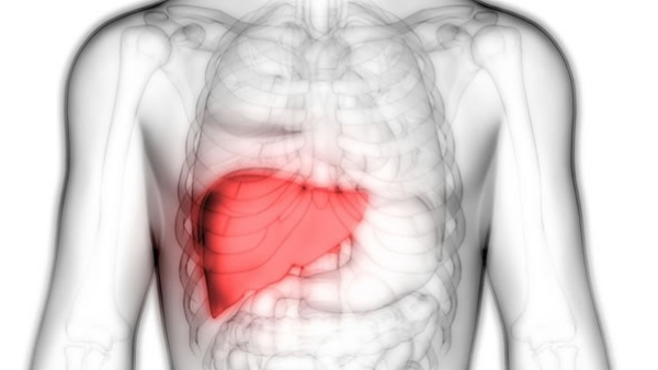 面對肝衰竭，你知道如何選擇最佳治療方案嗎？