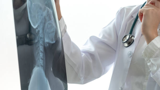 4種可行的治療強直性脊柱炎發(fā)方法，你都了解嗎？