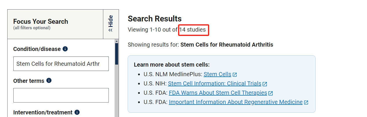 干細胞治療類(lèi)風(fēng)濕關(guān)節炎的臨床研究項目有14項。其中已完成的有2項。