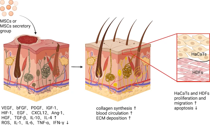 圖5：間充質(zhì)干細胞促進(jìn)皮膚創(chuàng  )面愈合的機制。