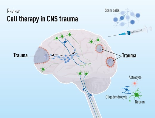干細胞療法修復中樞神經(jīng)系統創(chuàng  )傷：4個(gè)原則—什么、何時(shí)、何地和為什么