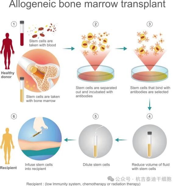 干細胞移植治療需要多長(cháng)時(shí)間？