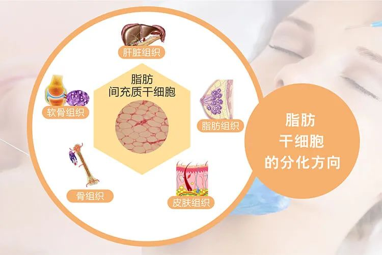 什么是脂肪干細胞：脂肪干細胞來(lái)源、臨床應用