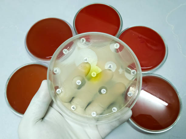 骨髓移植成功率100％嗎？