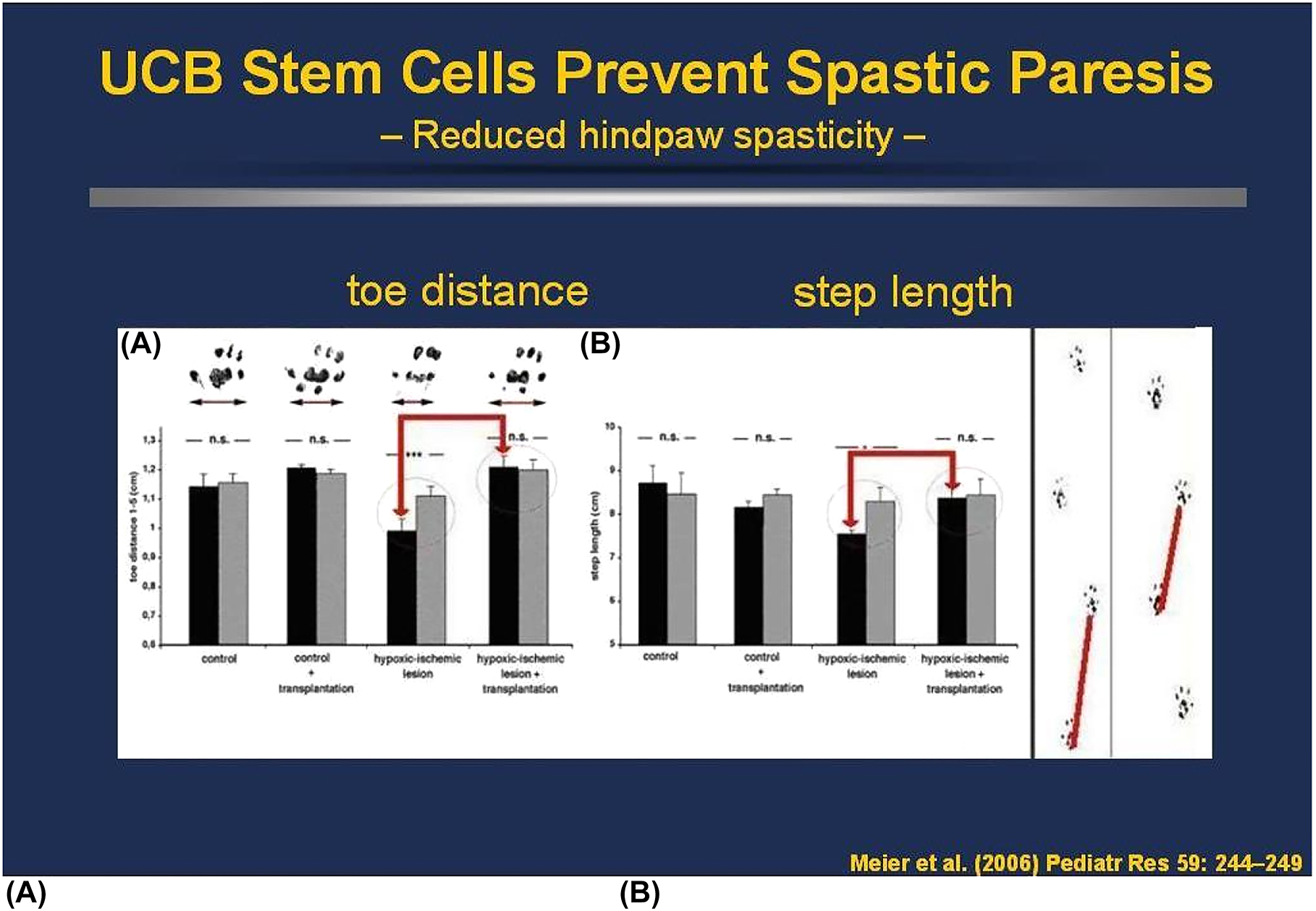 人類(lèi)臍帶血MNC可預防PN7新生大鼠模型的痙攣性輕癱