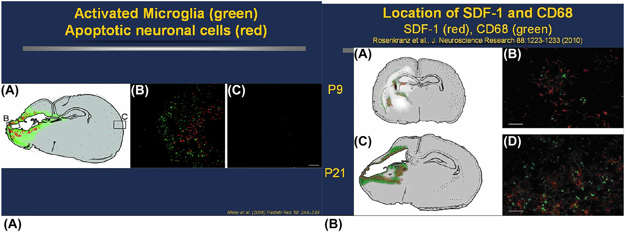 新生大鼠PN9和 PN21 HI后激活的小膠質(zhì)細胞和SDF-1表達